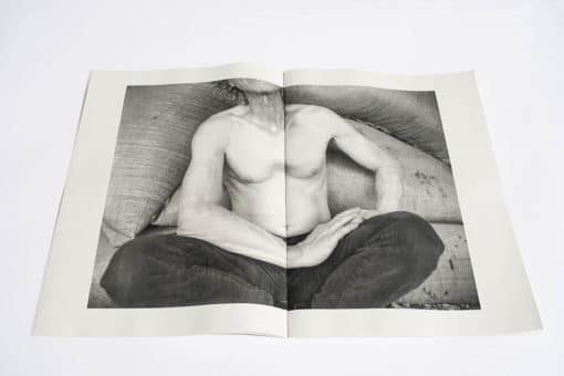 Pectus Excavatum - Quentin Yvelin – Image 10